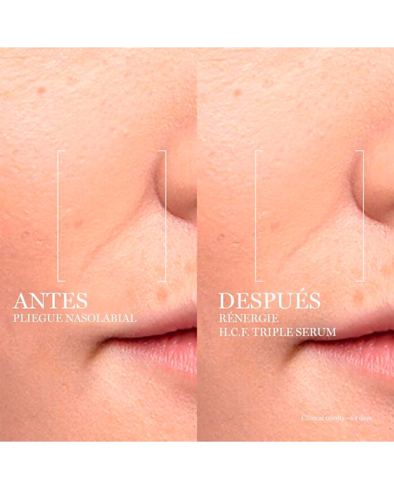 Renergie-H.C.F.-Triple-Serum