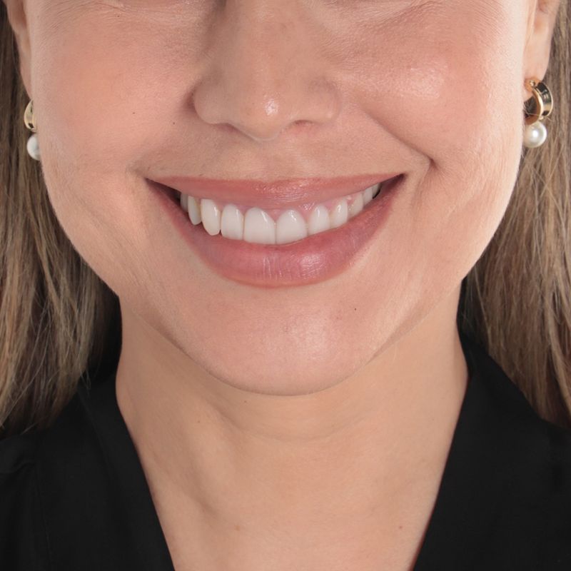 104809013-Aretes-dorado-para-mujer