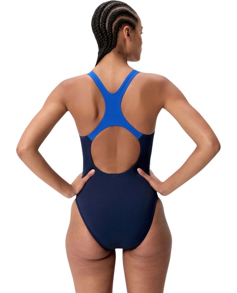 side view