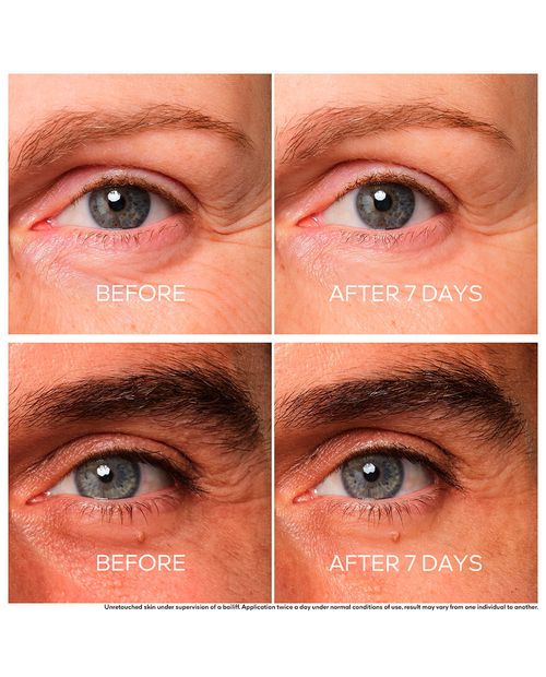 Tratamiento de Ojos Reparador de Juventud Abeille Royale Guerlain
